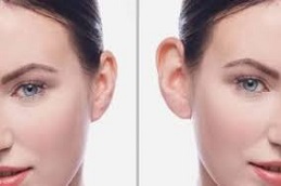 جراحة تجميل الأذن في دبي وأبو ظبي والشارقة والعين