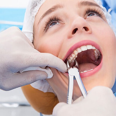 Best-Tooth-Removal-in-Abu-Dhabi-Al-Ain-Tooth-Removal-Cost