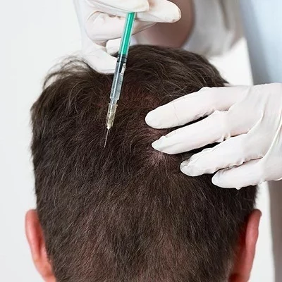 تكلفة زراعة الشعر بالخلايا الجذعية في الإمارات العربية المتحدة