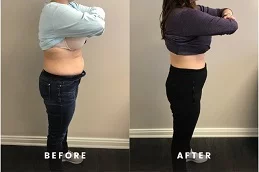 حقن مونجارو في دبي حقن مونجارو في دبي وأبو ظبي والشارقة والعين