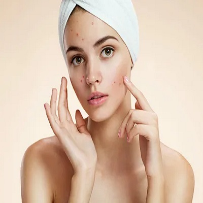 أفضل طبيب جلدية لعلاج حب الشباب أفضل طبيب جلدية لعلاج حب الشباب في دبي وأبو ظبي