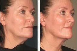 علاج آلثيرابي في دبي علاج ألثيرابي في دبي وأبوظبي