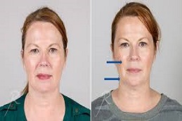 علاج آلثيرابي في دبي علاج ألثيرابي في دبي وأبوظبي