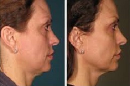 علاج آلثيرابي في دبي علاج ألثيرابي في دبي وأبوظبي