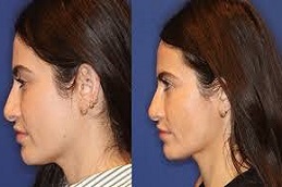 علاج آلثيرابي في دبي علاج ألثيرابي في دبي وأبوظبي